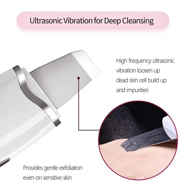 3-in-1 Ultrasonic Facial Spatula For Deep Cleansing, Electric Ultrasonic Skin Scrubber - view 3