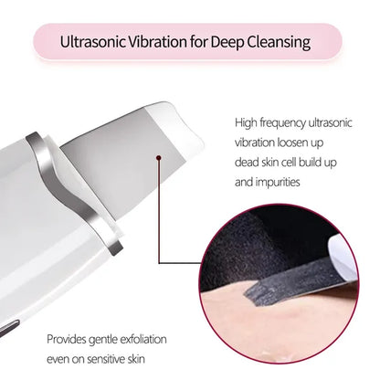 3-in-1 Ultrasonic Facial Spatula For Deep Cleansing, Electric Ultrasonic Skin Scrubber - view 3