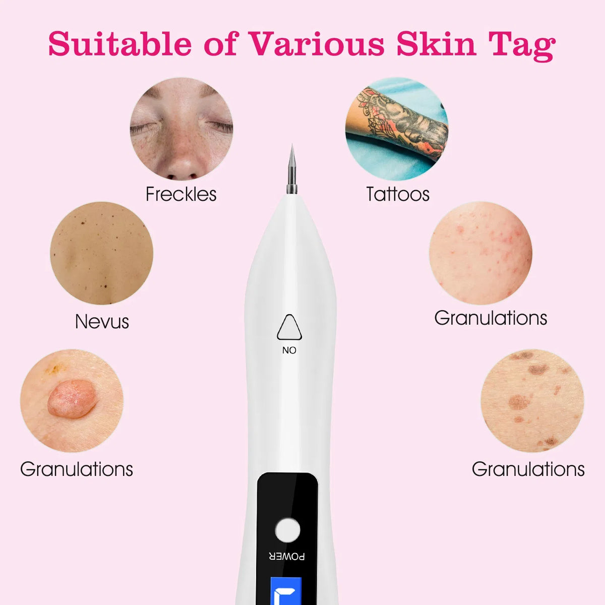 Skin Tag Repair Kit Portable Beauty Equipment Multi-Level With Home Usage USB Charging LCD Level Adjustable - view 8