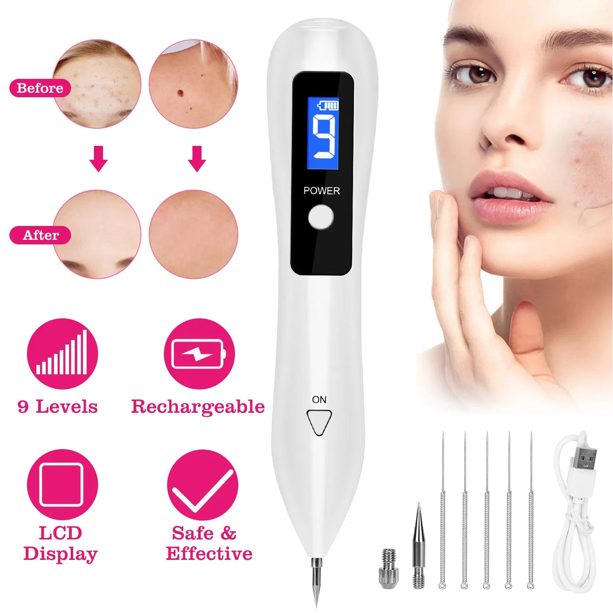 Skin Tag Repair Kit Portable Beauty Equipment Multi-Level With Home Usage USB Charging LCD Level Adjustable - view 5