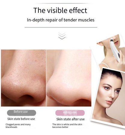 Electric Blackhead Remover Cleaner Face Diamond Pore Vacuum Suction White Heads - view 10