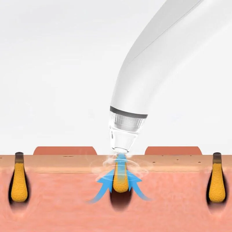 Electric Blackhead Remover Cleaner Face Diamond Pore Vacuum Suction White Heads - view 9