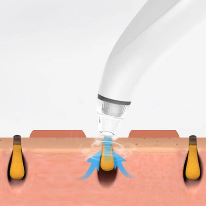 Electric Blackhead Remover Cleaner Face Diamond Pore Vacuum Suction White Heads - view 9