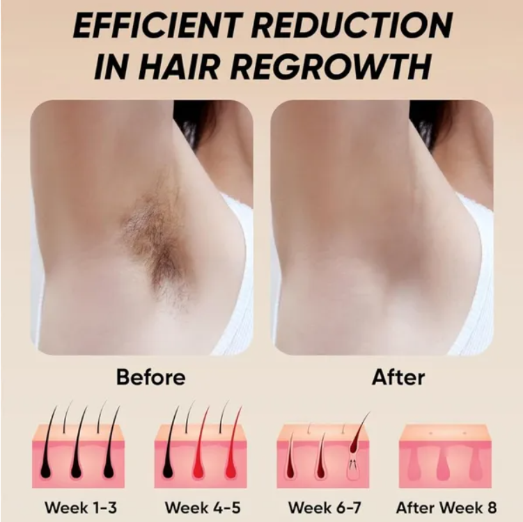Professional Laser Epilator IPL Hair Removal Body Bikini Leg Depilatory Devic 900 - view 9