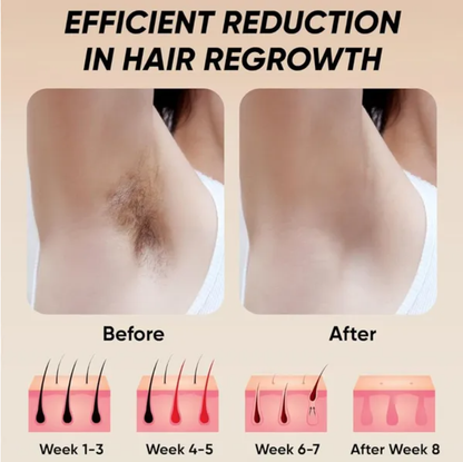 Professional Laser Epilator IPL Hair Removal Body Bikini Leg Depilatory Devic 900 - view 9