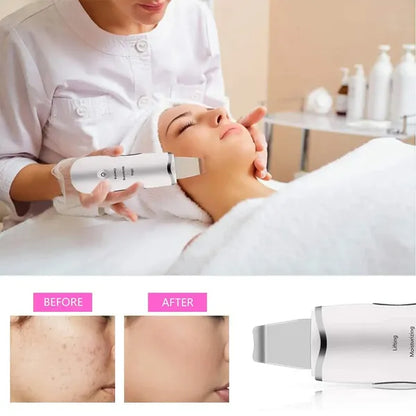 3-in-1 Ultrasonic Facial Spatula For Deep Cleansing, Electric Ultrasonic Skin Scrubber - view 5