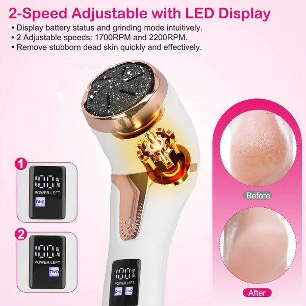 17Pcs Electric Foot Callus Remover With Vacuum Foot Grinder Rechargeable Foot File Dead Skin Pedicure Machine - view 3