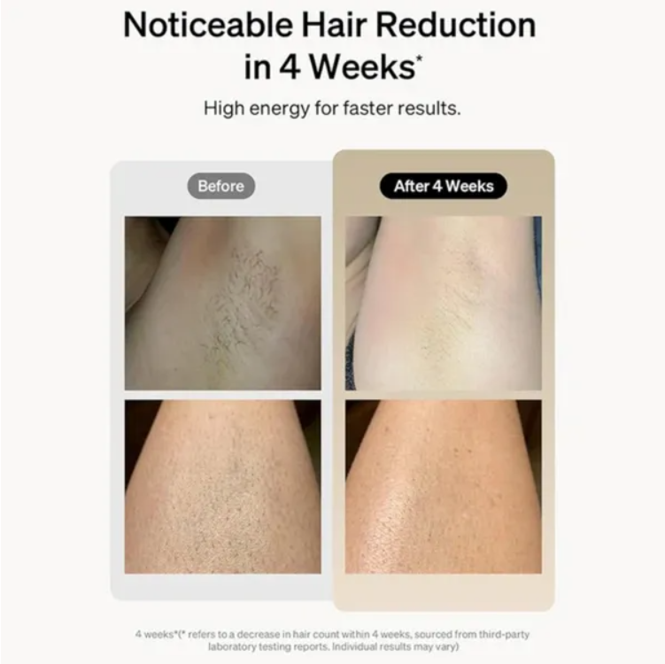 Professional Laser Epilator IPL Hair Removal Body Bikini Leg Depilatory Devic 900 - view 6