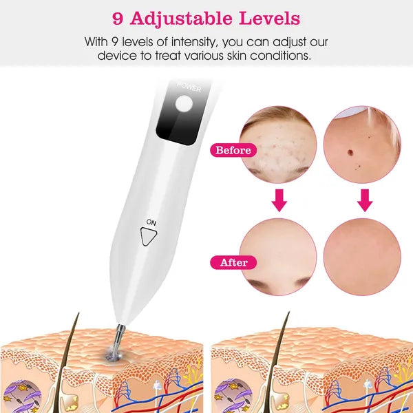Skin Tag Repair Kit Portable Beauty Equipment Multi-Level With Home Usage USB Charging LCD Level Adjustable - view 3