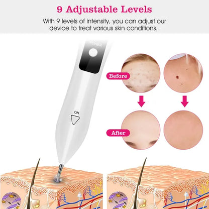Skin Tag Repair Kit Portable Beauty Equipment Multi-Level With Home Usage USB Charging LCD Level Adjustable - view 3